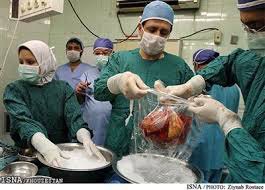 اخبار,اخباراجتماعی,پیوند اعضا اخبار,اخباراجتماعی,پیوند اعضا