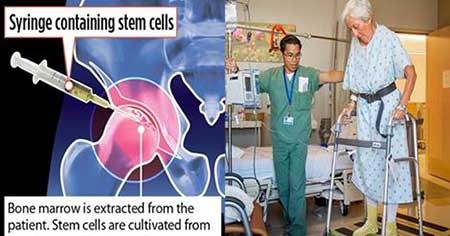 اخبار,اخبار علمی ,ترمیم مفصل استخوان ران