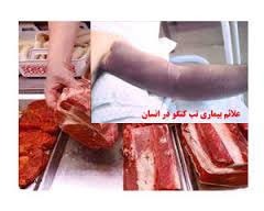 اخبار,اخبار اجتماعی , تب کریمه کنگو
