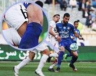 اخبارورزشی,خبرهای ورزشی,چشمی