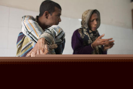 مرد درختی بنگلادشی در بیمارستانی در داکا – این جوان 25 ساله از 10 سالگی از یک بیماری نادر پوستی به نام عکسهای جالب,عکسهای جذاب