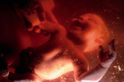   اخبارپزشکی,خبرهای پزشکی ,سقط جنین 