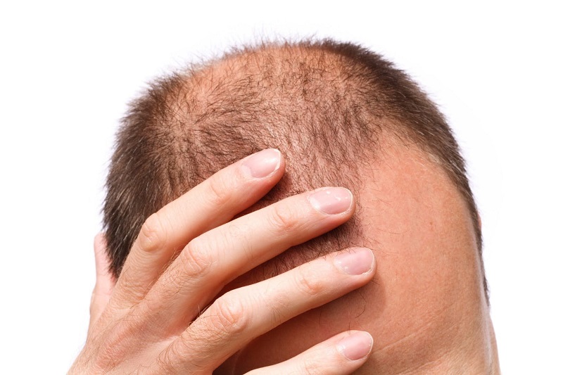 اخبار پزشکی ,خبرهای پزشکی , اخبار پزشکی ,خبرهای پزشکی,