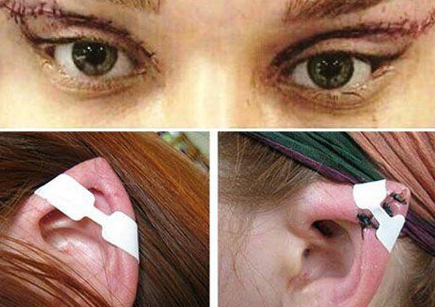 اخبار پزشکی ,خبرهای پزشکی ,جراحیهای چشم گربهای اخبار پزشکی ,خبرهای پزشکی,جراحیهای چشم گربهای