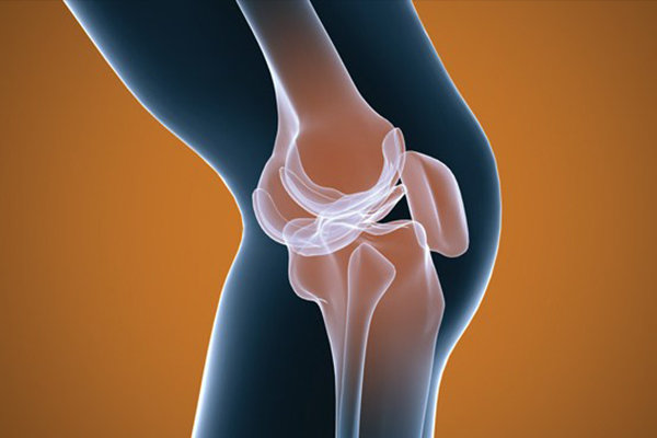 اخبار پزشکی ,خبرهای پزشکی ,آرتروز اخبار پزشکی ,خبرهای پزشکی,آرتروز