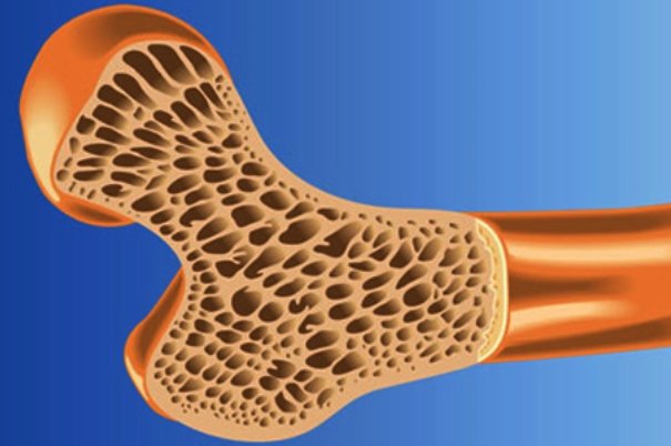  اخبار پزشکی ,خبرهای پزشکی,رشد استخوان‌ها