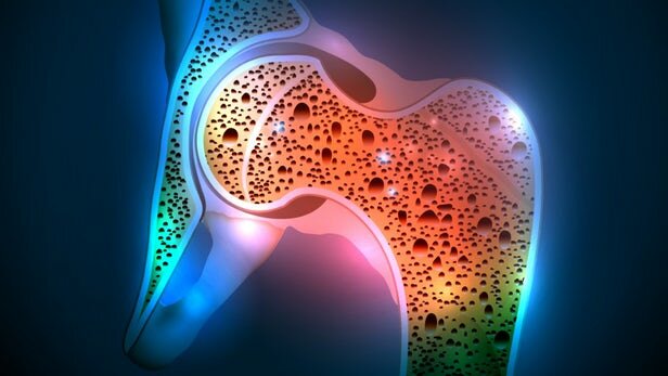 اخبار پزشکی ,خبرهای پزشکی ,استخوان اخبار پزشکی ,خبرهای پزشکی,استخوان