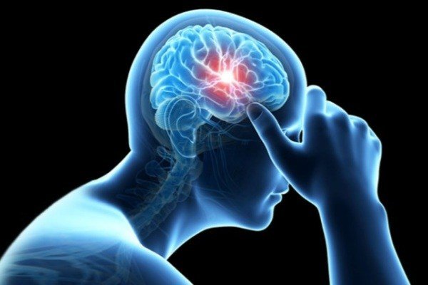 اخبار پزشکی ,خبرهای پزشکی ,سکته مغزی اخبار پزشکی ,خبرهای پزشکی,سکته مغزی