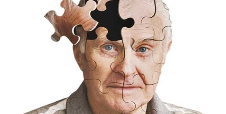 اخبار علمی,خبرهای علمی ,بیماری آلزایمر اخبار علمی ,خبرهای علمی,بیماری آلزایمر