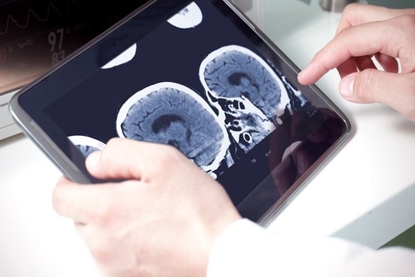 اخبار پزشکی ,خبرهای پزشکی , رژیم غذایی اخبار پزشکی ,خبرهای پزشکی, رژیم غذایی