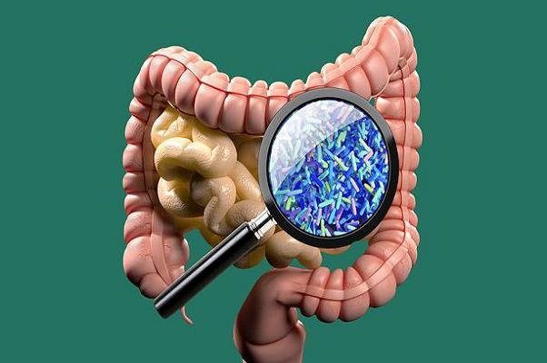 اخبار پزشکی ,خبرهای پزشکی ,میکروبیوم های روده اخبار پزشکی ,خبرهای پزشکی,میکروبیوم های روده