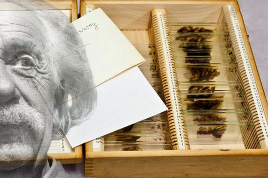 اخبارگوناگون,خبرهای گوناگون ,اعضای بدن انسان اخبارگوناگون,خبرهای گوناگون ,اعضای بدن انسان