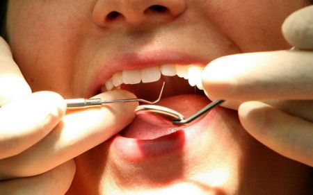 اخبار پزشکی ,خبرهای پزشکی , سفیدکنندههای دندان اخبار پزشکی ,خبرهای پزشکی, سفیدکنندههای دندان