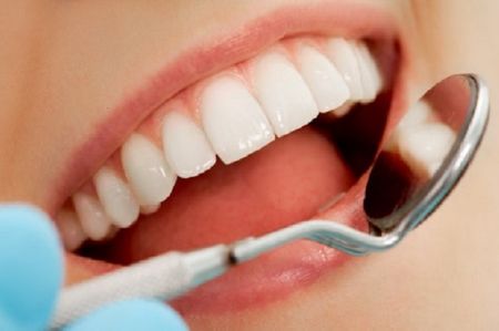 اخبار پزشکی ,خبرهای پزشکی , پوسیدگی دندان اخبار پزشکی ,خبرهای پزشکی, پوسیدگی دندان
