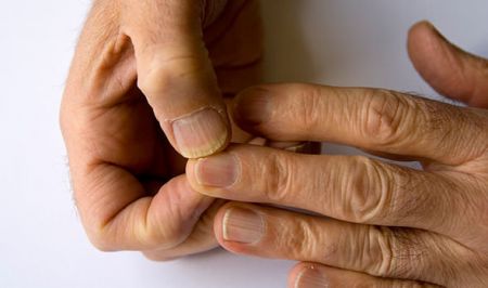 اخبار پزشکی ,خبرهای پزشکی ,دیابت اخبار پزشکی ,خبرهای پزشکی,دیابت
