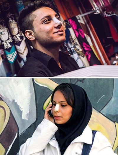  اخبارگوناگون,خبرهای گوناگون ,ملاک‌های عجیب زیبایی زنان