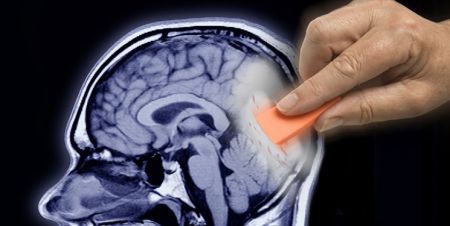 اخبار پزشکی ,خبرهای پزشکی ,آلزایمر اخبار پزشکی ,خبرهای پزشکی,آلزایمر
