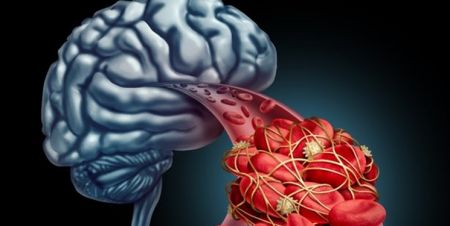 اخبار پزشکی ,خبرهای پزشکی ,آلزایمر اخبار پزشکی ,خبرهای پزشکی,آلزایمر