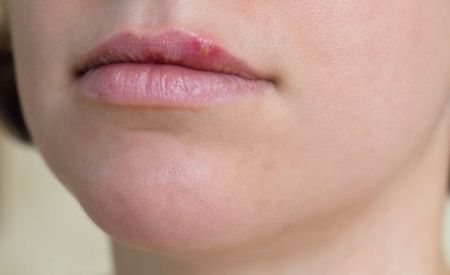 اخبار پزشکی ,خبرهای پزشکی ,عسل اخبار پزشکی ,خبرهای پزشکی,عسل