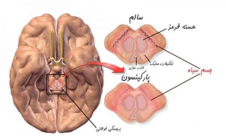 اخبار,اخبار پزشکی