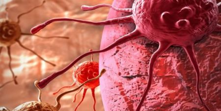 اخبار پزشکی ,خبرهای پزشکی ,چاقی اخبار پزشکی ,خبرهای پزشکی,چاقی