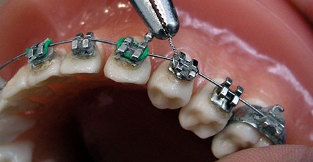  ارتودنسی,متخصص ارتودنسی,ارتودنسی دندان