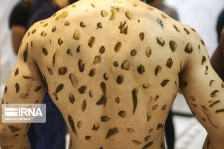 اخبار,عکس خبری,فیزیک سلامت اخبار,عکس خبری,فیزیک سلامت