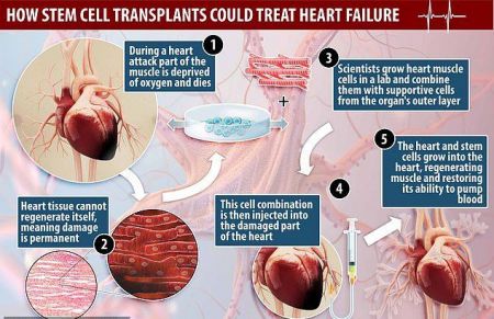  اخبار پزشکی ,خبرهای پزشکی,بازسازی بافت مرده قلب 