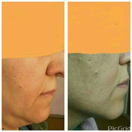 یوگای صورت و گردن یوگای صورت,آموزش یوگای صورت,یوگای صورت و گردن