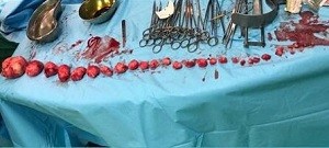 اخبار پزشکی ,خبرهای پزشکی , اخبار پزشکی ,خبرهای پزشکی,