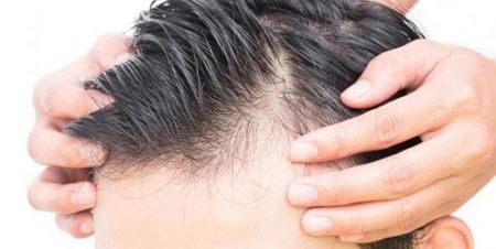 اخبار پزشکی ,خبرهای پزشکی , رشد موی بدن اخبار پزشکی ,خبرهای پزشکی, رشد موی بدن