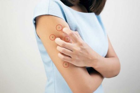 اخبارگوناگون,خبرهای گوناگون ,خال اخبارگوناگون,خبرهای گوناگون ,خال