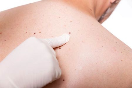اخبارگوناگون,خبرهای گوناگون ,خال اخبارگوناگون,خبرهای گوناگون ,خال