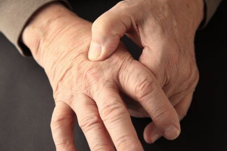 اخبار پزشکی ,خبرهای پزشکی ,سرطان روده اخبار پزشکی ,خبرهای پزشکی,سرطان روده