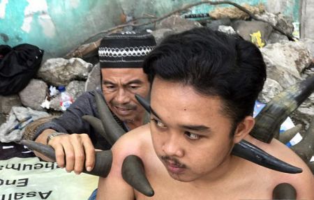 اخبار,اخبار گوناگون,حجامت با شاخ گاو اخبار,اخبار گوناگون,حجامت با شاخ گاو