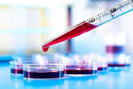 اخبار پزشکی ,خبرهای پزشکی ,دیابت اخبار پزشکی ,خبرهای پزشکی,دیابت