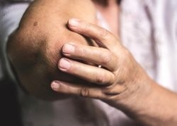 اخبار پزشکی ,خبرهای پزشکی ,روماتیسم مفصلی اخبار پزشکی ,خبرهای پزشکی,روماتیسم مفصلی