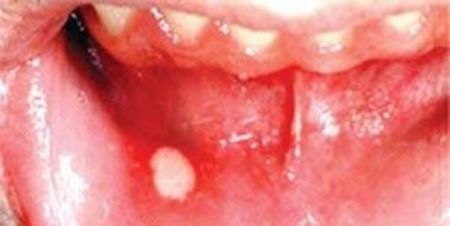 اخبار پزشکی ,خبرهای پزشکی , اخبار پزشکی ,خبرهای پزشکی,