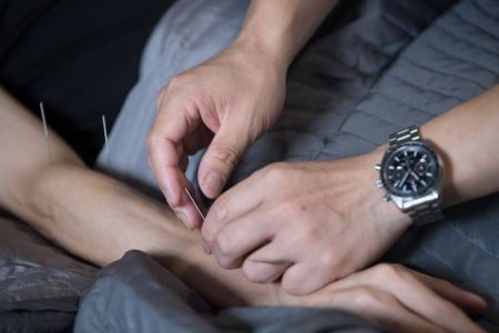 اخبار پزشکی ,خبرهای پزشکی ,طب سوزنی اخبار پزشکی ,خبرهای پزشکی,طب سوزنی