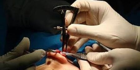 اخبار پزشکی ,خبرهای پزشکی ,جراحی زیبایی اخبار پزشکی ,خبرهای پزشکی,جراحی زیبایی