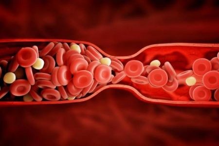 اخبار پزشکی ,خبرهای پزشکی , لختگی خون اخبار پزشکی ,خبرهای پزشکی, لختگی خون