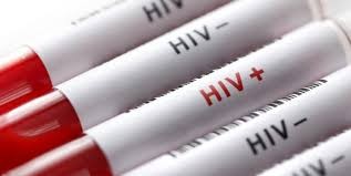  اخبار پزشکی ,خبرهای پزشکی,HIV