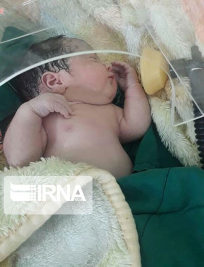 اخبار,اخبار پزشکی, نوزاد متولد شده از مادر بابلیِ مبتلا به کرونا اخبار,اخبار پزشکی, نوزاد متولد شده از مادر بابلیِ مبتلا به کرونا