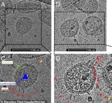 اخبار,اخبارپزشکی,ظاهر واقعی کرونا زیر میکروسکوپ