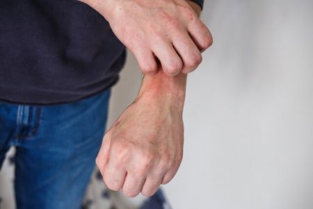 اخبار,اخبار پزشکی,خارش بدن اخبار,اخبار پزشکی,خارش بدن