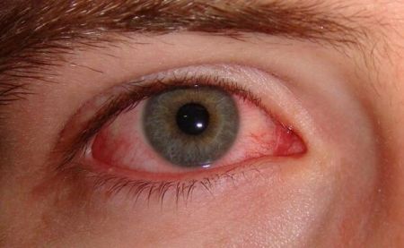 اخبار پزشکی ,خبرهای پزشکی , کرونا اخبار پزشکی ,خبرهای پزشکی, کرونا