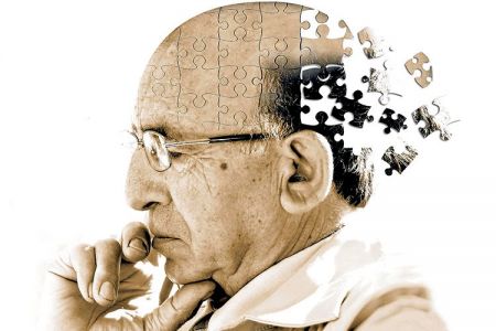 اخبار,اخبار پزشکی,آلزایمر اخبار,اخبار پزشکی,آلزایمر