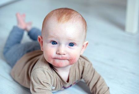 اخبار پزشکی ,خبرهای پزشکی ,کرونا اخبار پزشکی ,خبرهای پزشکی,کرونا