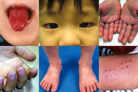 اخبار پزشکی ,خبرهای پزشکی ,کرونا اخبار پزشکی ,خبرهای پزشکی,کرونا