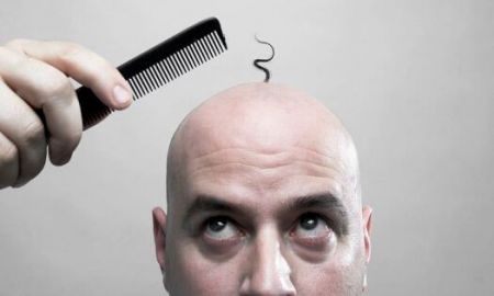 اخبار,اخبار پزشکی,ابتلای افراد طاس به کرونا اخبار,اخبار پزشکی,ابتلای افراد طاس به کرونا